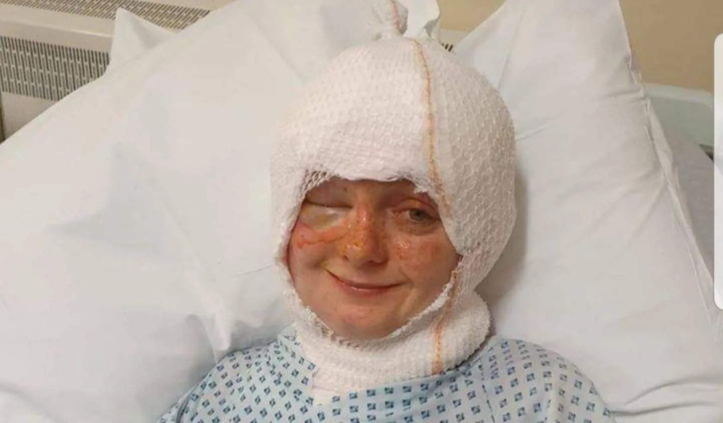 Suurbritanniast pärit Emily läks küünlaleeki kustutama, kuid sattus hoopis haiglasse.