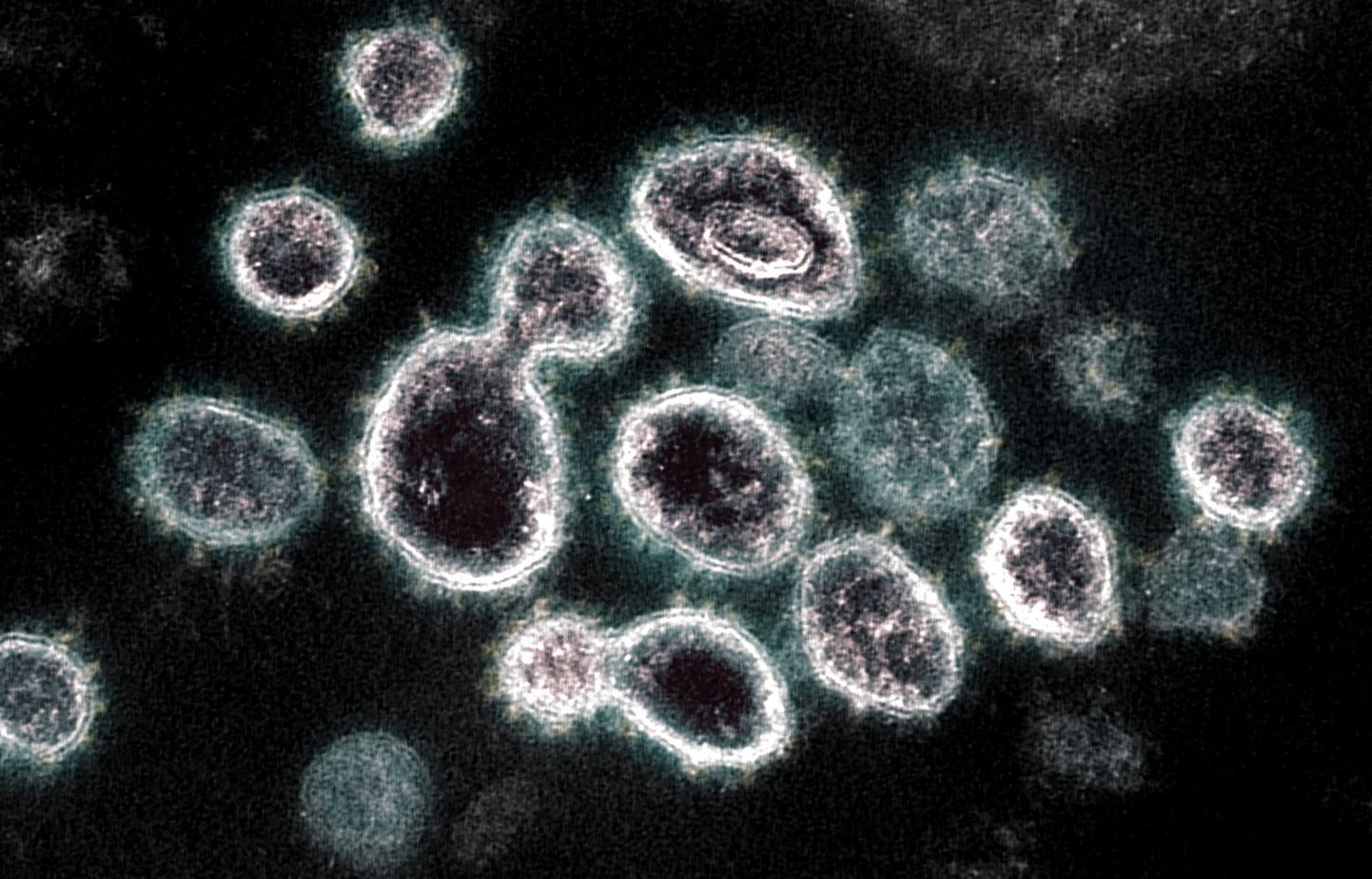 SARS-CoV-2 ehk koroonaviirus mikroskoobi all