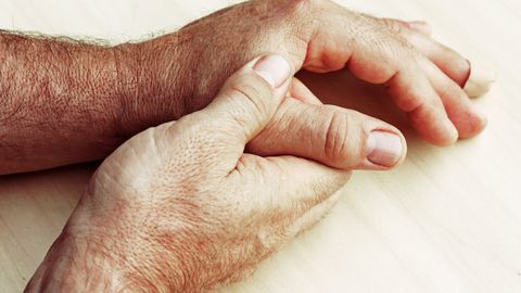 Parkinsoni haigus algab aastaid enne liikumisvõimet pärssivate sümptomite avaldumist. Parkinsoni haigus algab aastaid enne liikumisvõimet pärssivate sümptomite avaldumist.