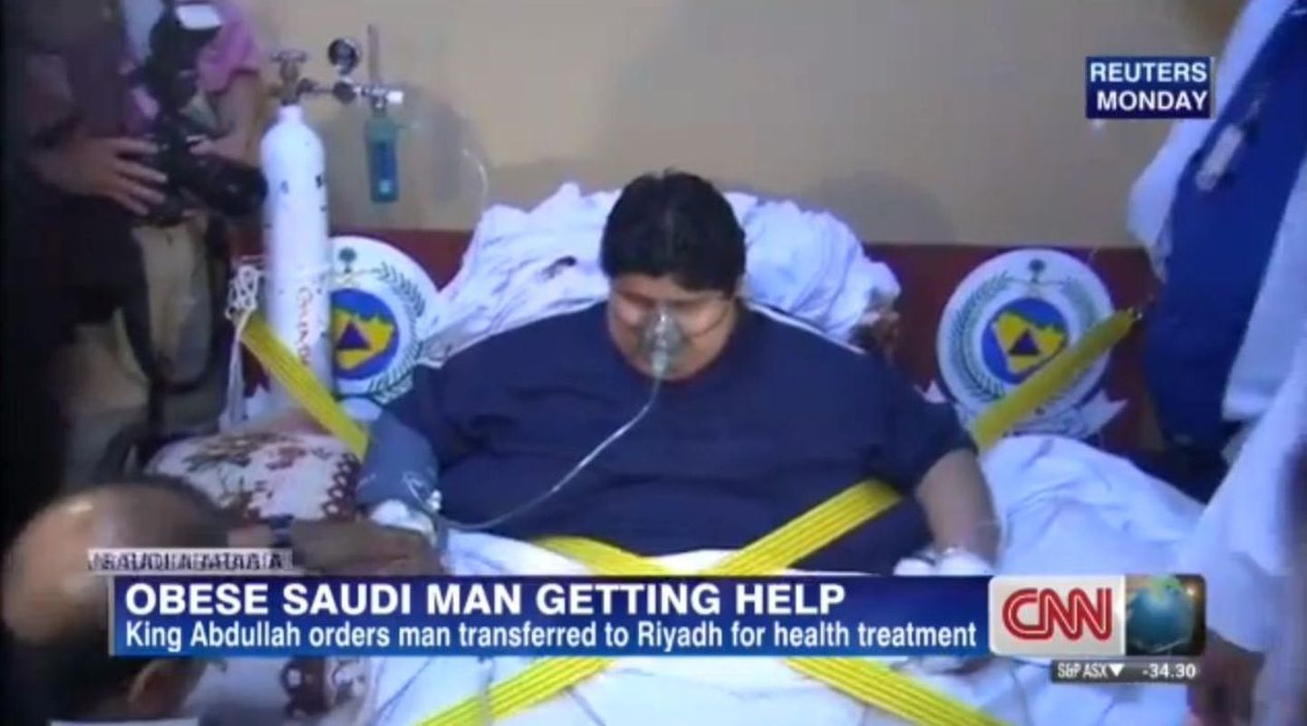 610-kilogrammine mees pääses Saudi Araabia kuninga abiga haiglasse
