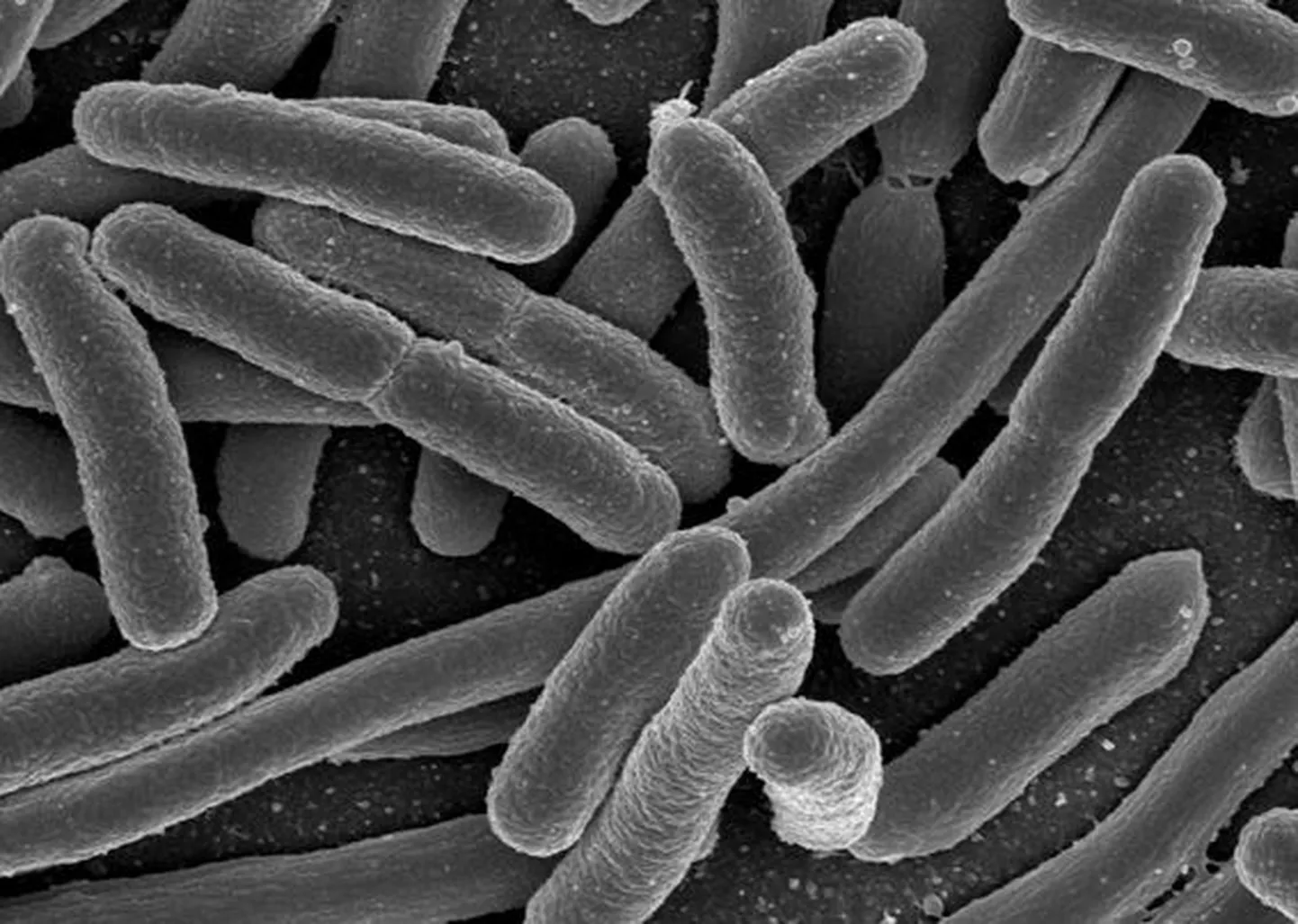 OÜ Kunda Vesi tellitud uuring  Escherichia Coli olemasolu Kunda joogivees ei tuvastanud.