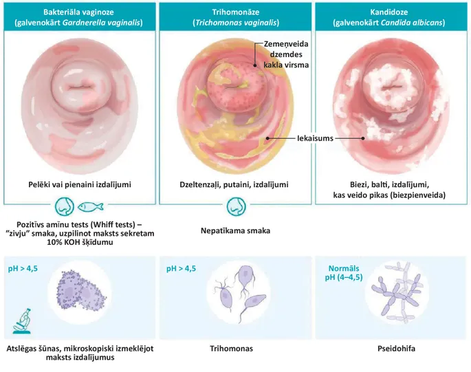 Vaginal koptoklar bilan rasmlar