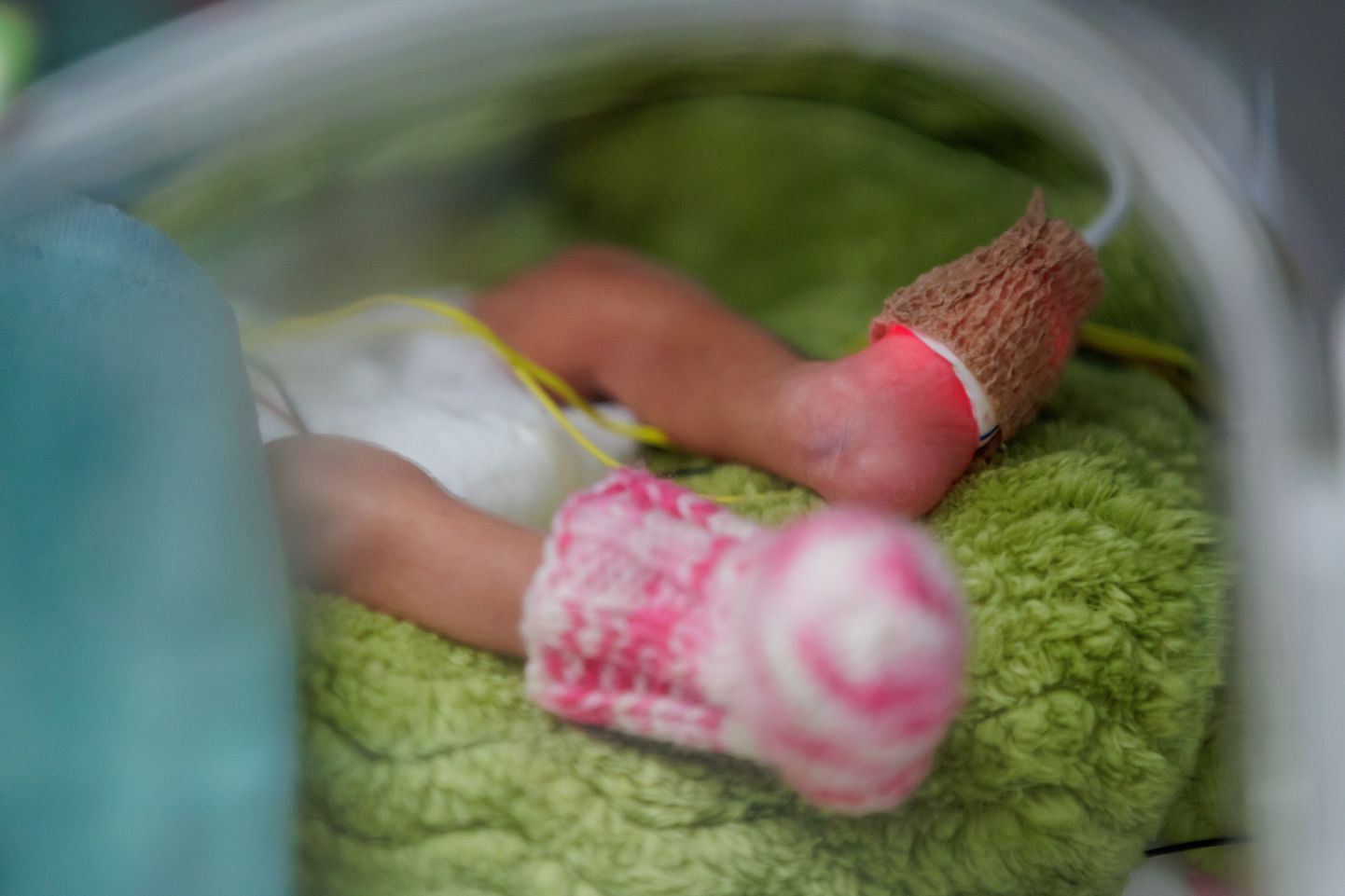 Крошечная девочка на фотографии родилась глубоко недоношенной около недели назад.